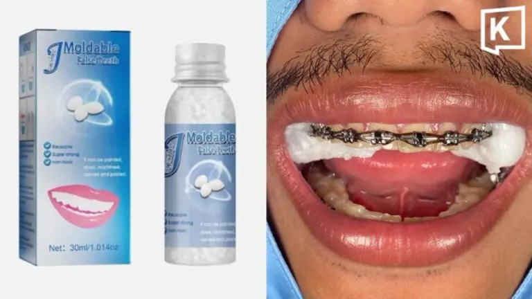 Dental Clinic Removes Hardened DIY Silicone After Two Hours