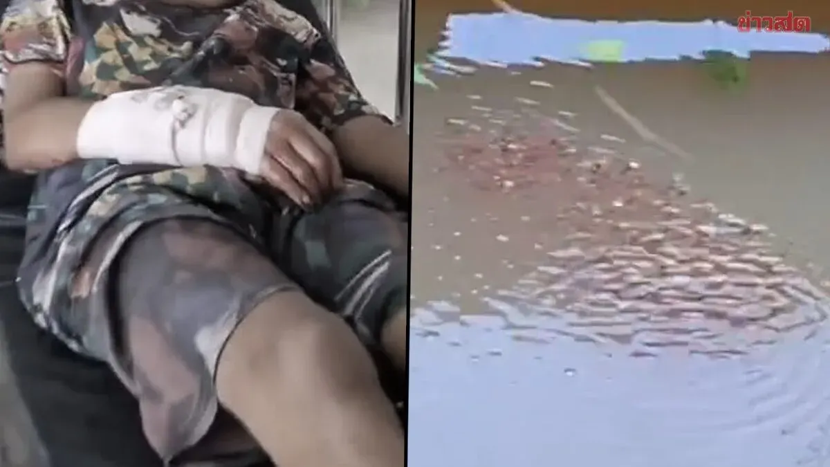 Mother Snakehead Fish Injures Boy in Flood‑Hit Village