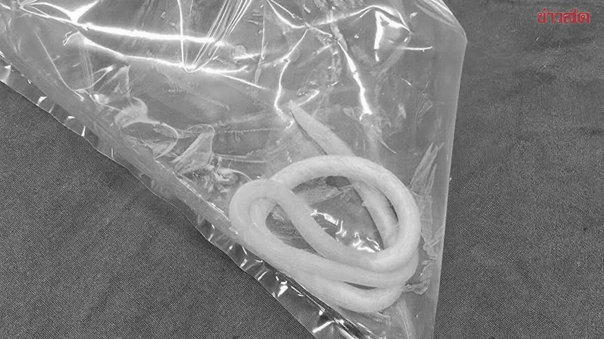Why Roundworms Came Out Of Toddler's Mouth