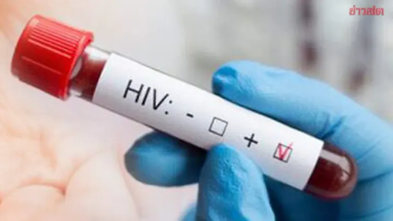 Songkhla Reports 10,644 HIV Cases, Mostly Youth and Workers
